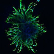 Mammary tumor organoids undergo a radical shape shift when treated with a microRNA. 