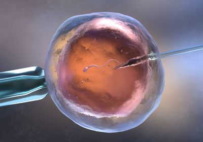 Image of in vitro fertilization