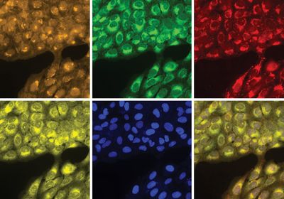 The image shows six different panels containing cells. On each panel, the cells are labelled using a different fluorescent dye that highlights features of a specific organelle within the cells.