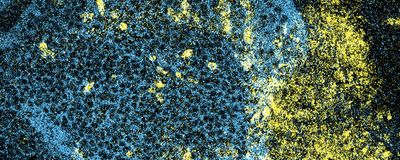 A colored microscopy image showing cells that are dying in yellow and healthy cells in blue