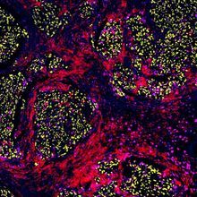 A false-colored micrograph showing swirls of yellow, red, and magenta cells