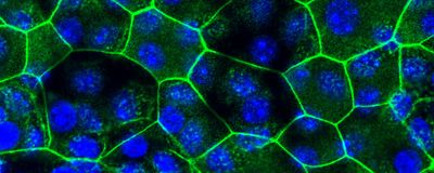 Bladder epithelial tissue, where cell junctions are shown in green and nuclei in blue. This was grown in vitro from cells taken from mice with chronic cystitis.