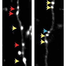 SYNGAP1 helps neurons eliminate old synapses and form new ones after a novel experience (left and center left)—a process weakened in mice missing a copy of the gene (center right and right).