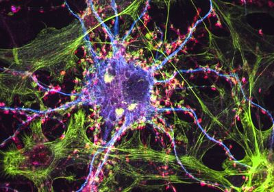 Nerve cell labelled with different colours