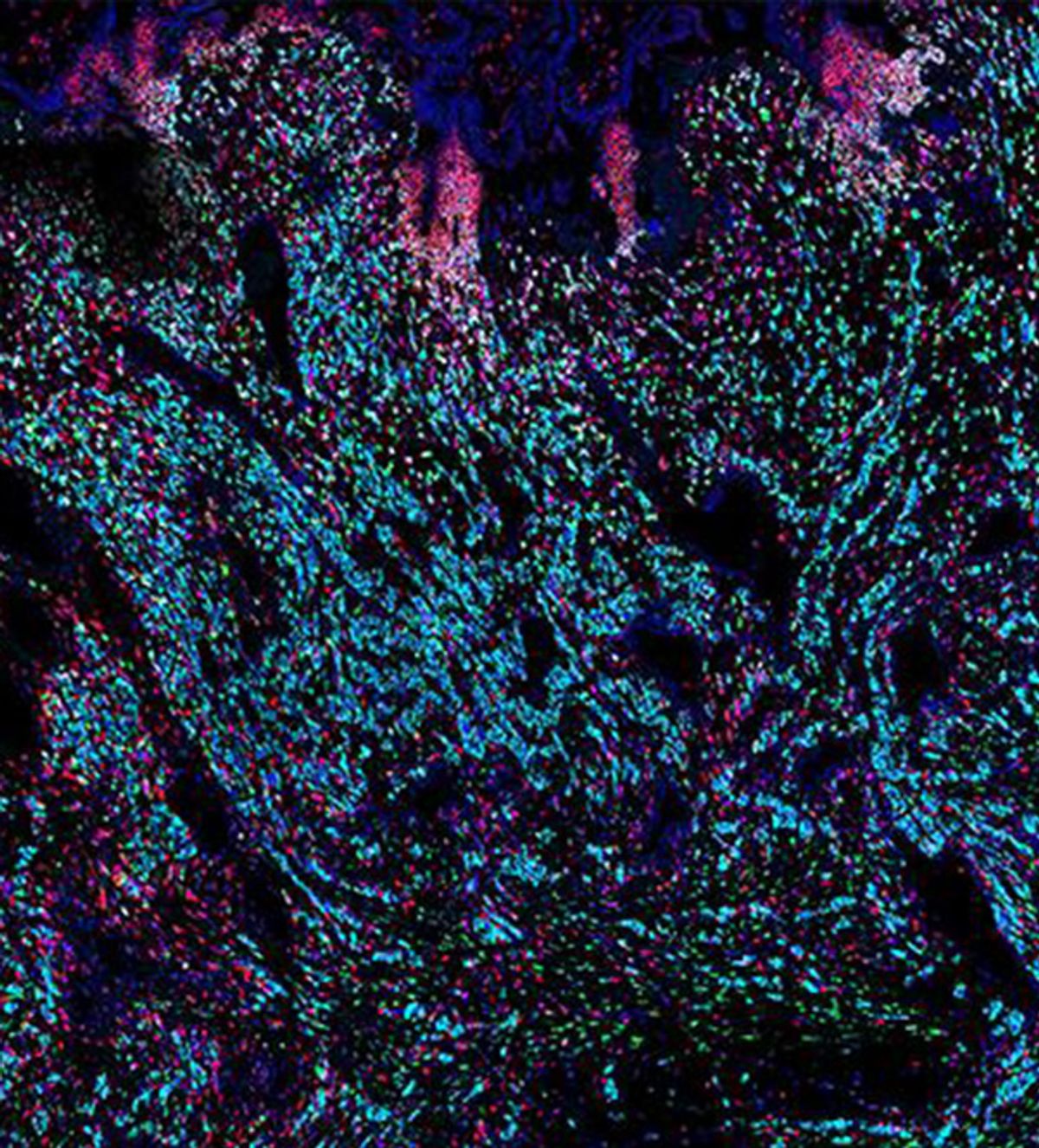 A fluorescence microscopy image of placenta tissue made up of cells dyed blue, purple, pink and green on a black background.