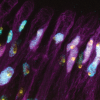 Stress-Induced Chromosome Changes Protect Flies&rsquo; Aging Brains