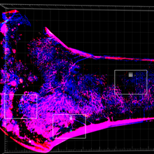 fluorescently labeled microscopy cross-section of bone