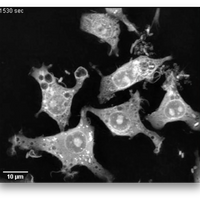 macrophage e coli nanolive microscopy
