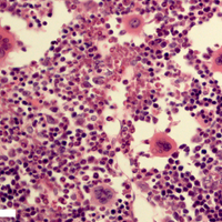 mice bone marrow hematopoietic stem cells